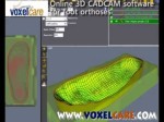 Voxelcare.com-Online 3D foambox CadCam insole orthotic orthosis design software